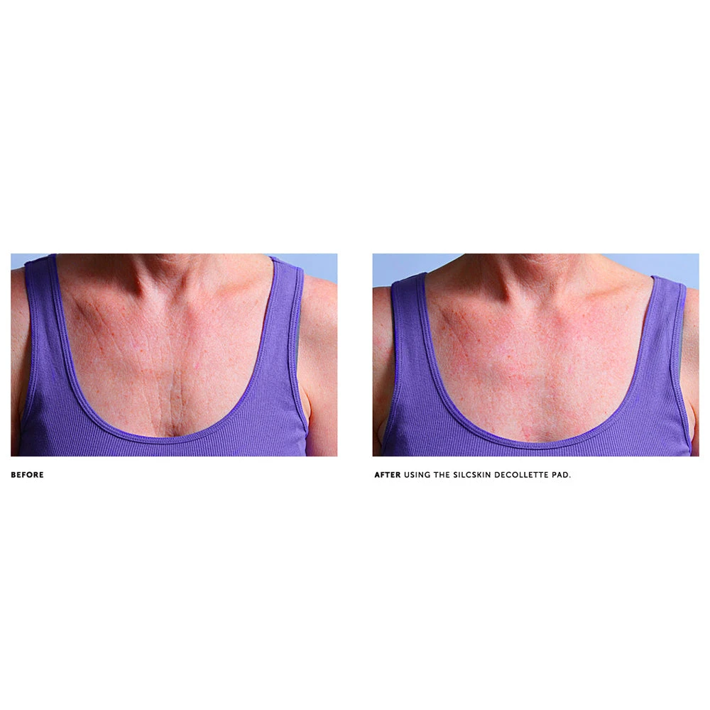 SilcSkin Decollette Pad 6 SilcSkin Decollette Pad - Image 4