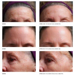 SilcSkin Brow Set Facial Pads -LA ROCHE-POSAY || Murad || SkinMedica Sales SIC0002.4