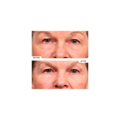 SilcSkin Eye Pads -LA ROCHE-POSAY || Murad || SkinMedica Sales SIC0005.4