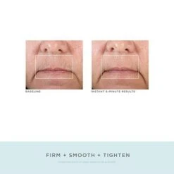 NuFACE FIX Line Smoothing Device - FINAL SALE -LA ROCHE-POSAY || Murad || SkinMedica Sales WblA1jZX