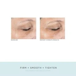 NuFACE FIX Line Smoothing Device - FINAL SALE -LA ROCHE-POSAY || Murad || SkinMedica Sales lc6C89yG